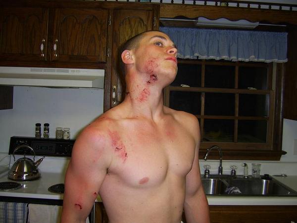 he was very lucky, it could have been a lot worse