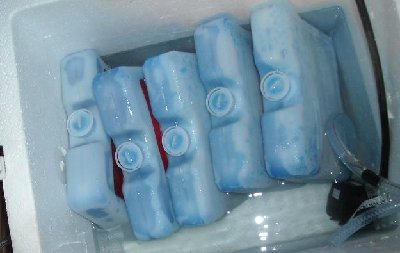 The ice packs in the chest.  A couple more would fit.  Time will tell if they are needed.